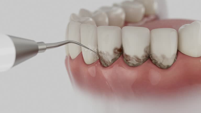 Reliable Dental contractor in Pierce County County, ND by Dentist Open Now